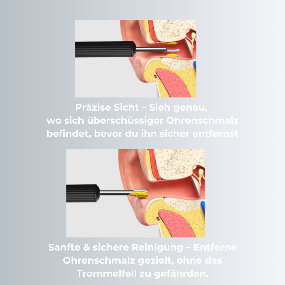 SmartEar Vision